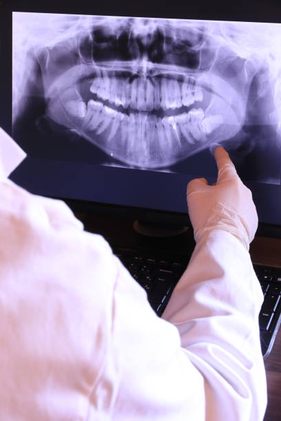 Best Emergency Tooth Extraction in Willimantic, CT
