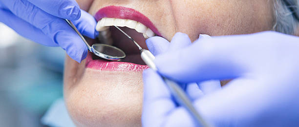 Best Emergency Wisdom Teeth Removal in Willimantic, CT